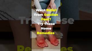 Discover 9 Best Home Remedies for Swollen Feet and Ankles #shorts