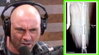Joe Rogan FREAKS OUT Over Brutal Leg-Lengthening Surgery!
