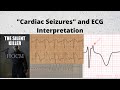 Cardiac seizures (HOCM, ARVC, Brugada Syndrome, Long QT syndrome/polymorphic VT)