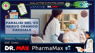 😷 PARALISI DEL VII NERVO CRANICO CACCIALE Che Malattia o Patologia è ? Info Salute