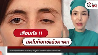 เตือนภัย!!  ฉีดโบท็อกซ์แล้วตาตก l Doctornatclinic