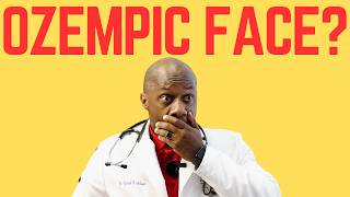 OZEMPIC FACE EXPLAINED
