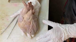Heart autopsy Part 2 - Inflow and Outflow method
