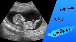 همه چیز راجع به سونوگرافی