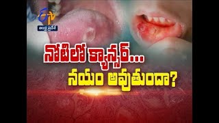 Oral Cancers And Treatment Options | Sukhibhava | 12th July 2021 | ETV Andhra Pradesh