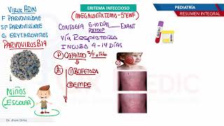 Pediatría - Exantemas   Eritema infeccioso