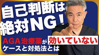 AGA治療薬”フィナステリド”が効いていないときに絶対やってはいけないこと