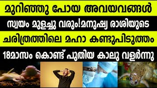 മുറിഞ്ഞു പോയ അവയവങ്ങൾ സ്വയം മുളച്ചു വരും!  മഹാ കണ്ടുപിടുത്തം;18മാസം കൊണ്ട് പുതിയ കാലു !!