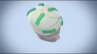 DigniCap Cooling Wrap 3D Animation