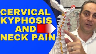 Cervical Kyphosis And Neck Pain REVERSAL CERVICAL LORDOSIS Dr Walter Salubro Chiropractor In Vaughan