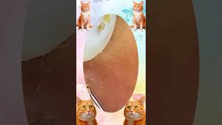 Blackheads Removal | Acne Treatment and Very Satisfying Satisfying Pimple pop #blackheads