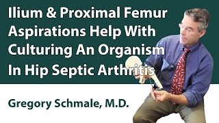 Ilium \u0026 Proximal Femur Aspirations Help With Culturing An Organism In Hip Septic Arthritis