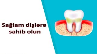 Bu üsulla dişləriniz sağlam olacaq - Sağlam dişlərə sahib olun