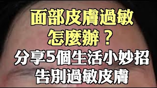 面部皮膚過敏怎麼辦？分享5個生活小妙招告別過敏皮膚