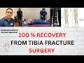 Learn Everything About Lower leg fractures Recovery & Exercises at Home | Urdu |Hindi