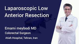 Laparoscopic Low Anterior Resection, Step by Step