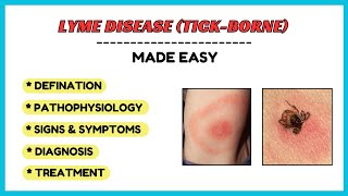 Lyme disease (Borrelia burgdorferi), symptoms, diagnosis, treatment, pathology made easy