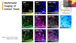 Multiplexed imaging of gold nanoclusters uptake by cancer cells and tissues