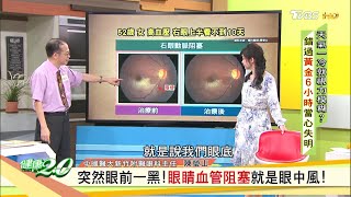 眼前一黑當心是眼中風！天冷泡湯溫差大要小心！ 健康2.0 20200105 (完整版)