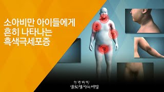 소아비만 아이들에게 흔히 나타나는 흑색극세포증 - (2018.3.28_641회 방송) 소아비만 골든타임을 잡아라