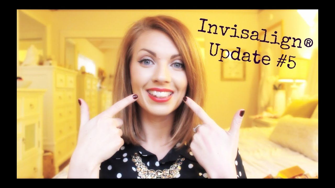 Invisalignﾂｮ Update 5 笙 Youtube
