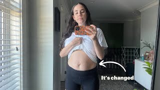 BODY AFTER MY NATURAL TWIN HOME BIRTH  // Stretch Marks, Bare Belly, Healing Techniques