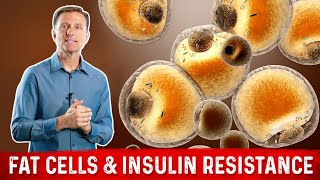 Does Losing Weight Reduce Insulin Resistance? – Dr.Berg