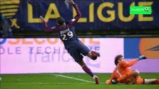 kylian mbappe horror injury vs Amiens 10.1.2018