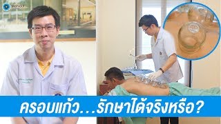 การครอบแก้ว แก้อาการออฟฟิศซินโดรม | พบหมอมหิดล [by Mahidol Channel]