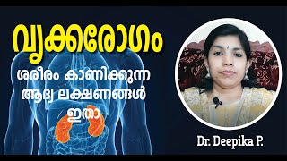 കി‍ഡ്‌നി രോഗം, ഇൗ ലക്ഷണങ്ങൾ നിങ്ങൾക്കുണ്ടോ | kidney disease | vrikka rogam | malayalam health Tips