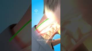 Mobile Addiction In Kids Damage Neck Bone Creativelearning3d