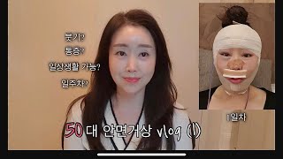 vlog. 50대 급 대공사 / 안면거상(+코) 브이로그 / 수술 당일부터 8일차까지 / 붓기와의 전쟁