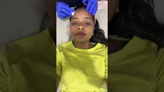 Hydra facial ചെയ്താൽ കിടിലം result ഉറപ്പ്🤩 #hydrafacial #result #youtube #shorts #skincare #best