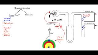 What is Conn's syndrome or Primary Hyperaldosteronism   MADE EASY