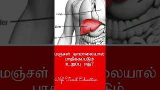 மஞ்சள் காமாலையால் பாதிக்கப்படும் உறுப்பு எது,Scientific Reason, Jaundice,Liver,Which organ is affect