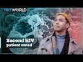 Second person cured of HIV after stem cell therapy