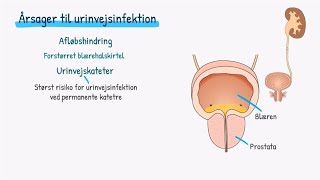 Nyrer og urinveje: Urinvejsinfektion