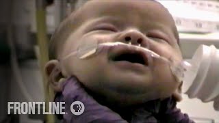 This Is What Whooping Cough Looks Like | The Vaccine War | FRONTLINE