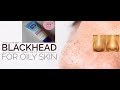 I used a Clean & Clear Blackhead clearing scrub DAILY I GET RID OF BLACKHEAD IN 2 DAYS I Mini Review