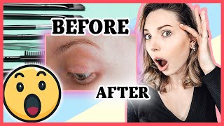 Hair Thinning From THYROID Disease? | My Brow SECRETS