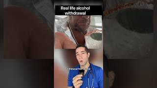 Why alcohol withdrawal is SO brutal
