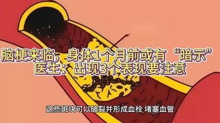 腦梗來臨，身體1個月前或有“暗示”？醫生：出現3個表現要注意