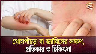 খোসপাঁচড়া বা স্ক্যাবিসের লক্ষণ, প্রতিকার ও চিকিৎসা | Scabies | Channel 24