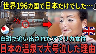 「世界196カ国で日本だけでした…」白斑で追い出されたアメリカの女性、日本の温泉で大号泣した理由【海外の反応】