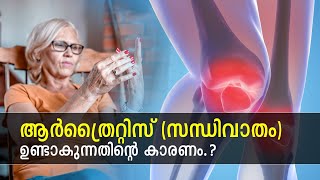 ആര്‍ത്രൈറ്റിസ് (സന്ധിവാതം) ഉണ്ടാകുന്നതിന്റെ കാരണം.? | Causes of Arthritis? | Ethnic Health Court