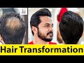 Amazing Hair Transformation by Master Stylist Surith - Salon Zero