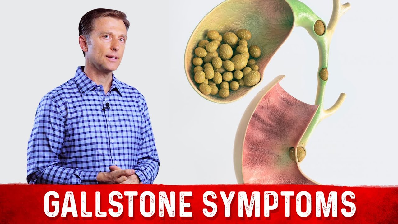 Gallstone Symptoms And Causes Explained – Dr.Berg On Gallbladder Stone ...