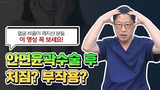 안면윤곽 수술 후 처짐? 부작용? 얼굴비율이 깨지신 분들 이 영상 꼭 보세요!