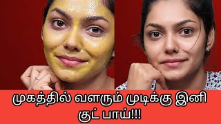 தேவையற்ற முடியை முகத்தில் அகற்ற எளிய குறிப்புகள்! | Facial hair removal tamil