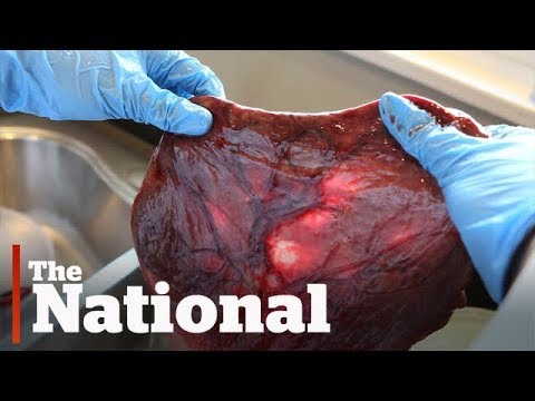 What is the purpose of the afterbirth?